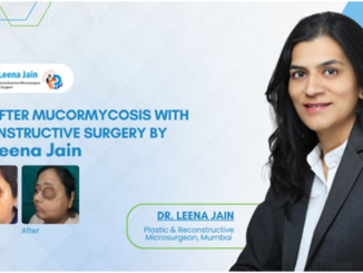 A post-COVID Mucormycosis Survivor gets a New Lease on Life after Dr Leena Jain successfully performs an Advanced Facial Reconstruction in Mumbai
