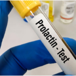 Prolactin Test: Early Detection for Hormonal Imbalance