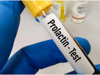 Prolactin Test: Early Detection for Hormonal Imbalance
