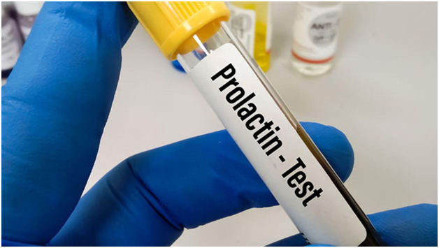 Prolactin Test: Early Detection for Hormonal Imbalance