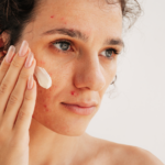 5 Best Lightweight Gel Moisturizers for Oily, Acne-Prone Skin in India