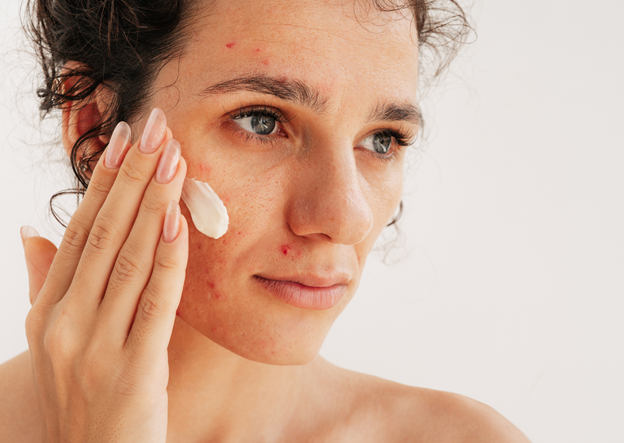 5 Best Lightweight Gel Moisturizers for Oily, Acne-Prone Skin in India